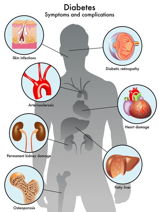 Insunol protège les organes cibles des complications